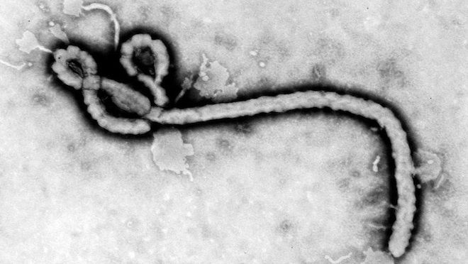 Ebola, alcune cose da sapere...