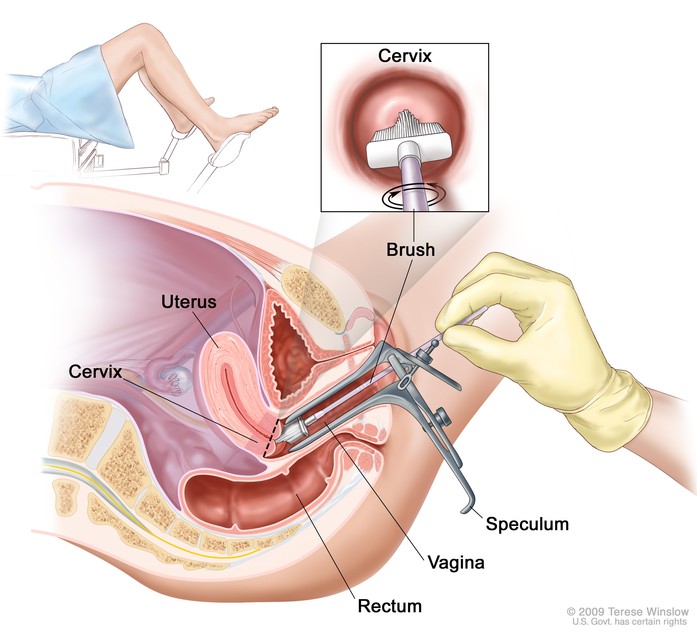 Visita ginecologica ed ecografia per prevenire i tumori dell'utero e dell'ovaio