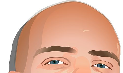 ALOPECIA: trattamento medico specialistico per i capelli con applicazioni ambulatoriali.