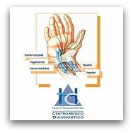 LA SINDROME DEL TUNNEL CARPALE - Diagnosi e trattamenti