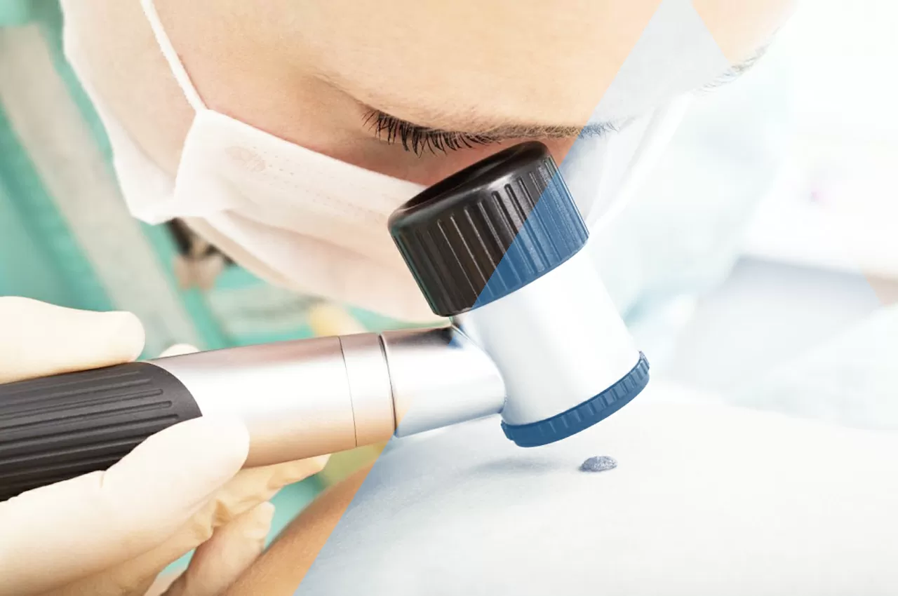 melanomi basaliomi e carcinomi HTC Centro Medico Stradella PV