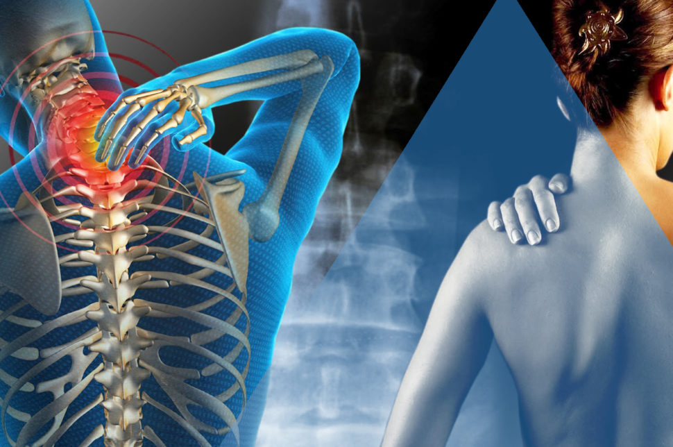 fibromialgia