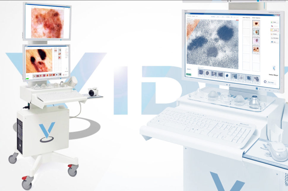 Mappatura dei nei computerizzata con videodermatoscopio digitale Vidix 4.0