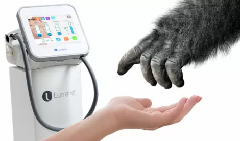 Epilazione laser medicale - HTC Centro Medico