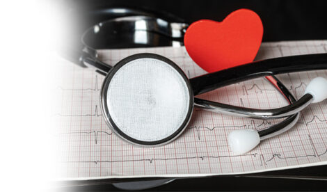 check up cardiovascolare - HTC Centro Medico Stradella Pavia