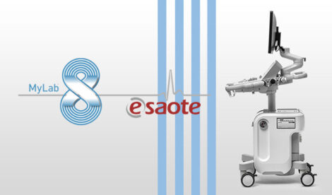 Nuova piattaforma ecografica esaote - HTC Centro Medico Stradella Pavia