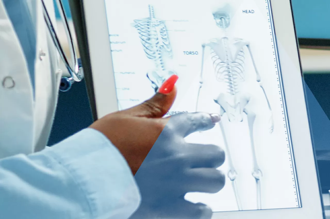 Per prevenire, diagnosticare e curare l'Osteoporosi, rivolgiamoci all'Endocrinologo