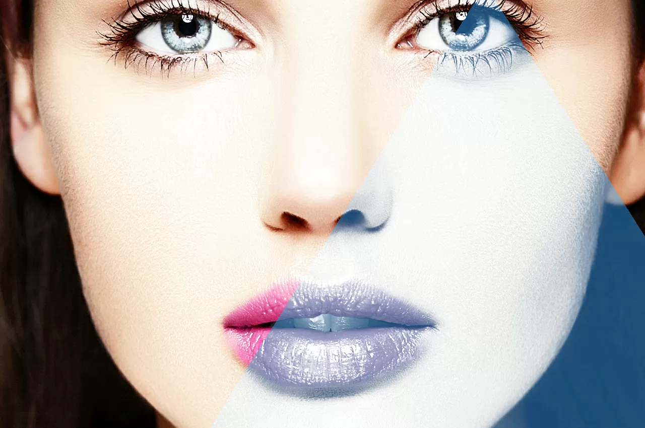 filler labbra - HTC Centro Medico Stradella