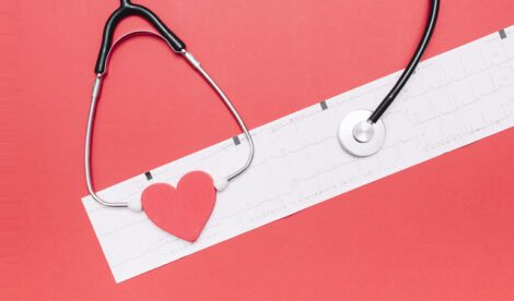 fibrillazione atriale - cardiologia - HTC Centro Medico Stradella Pavia