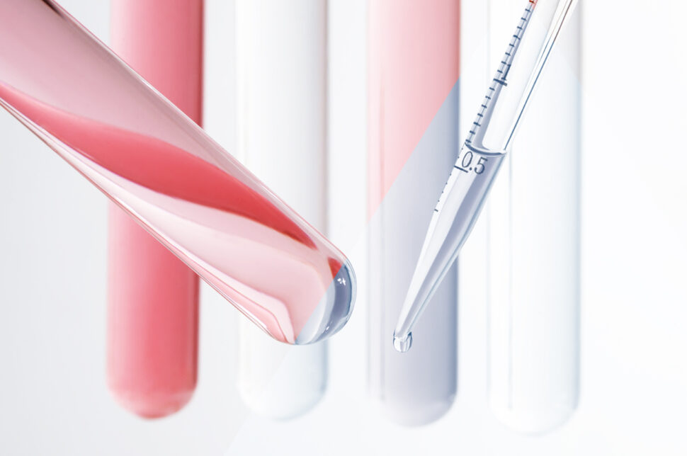 Acido ialuronico per problemi vescicali femminili