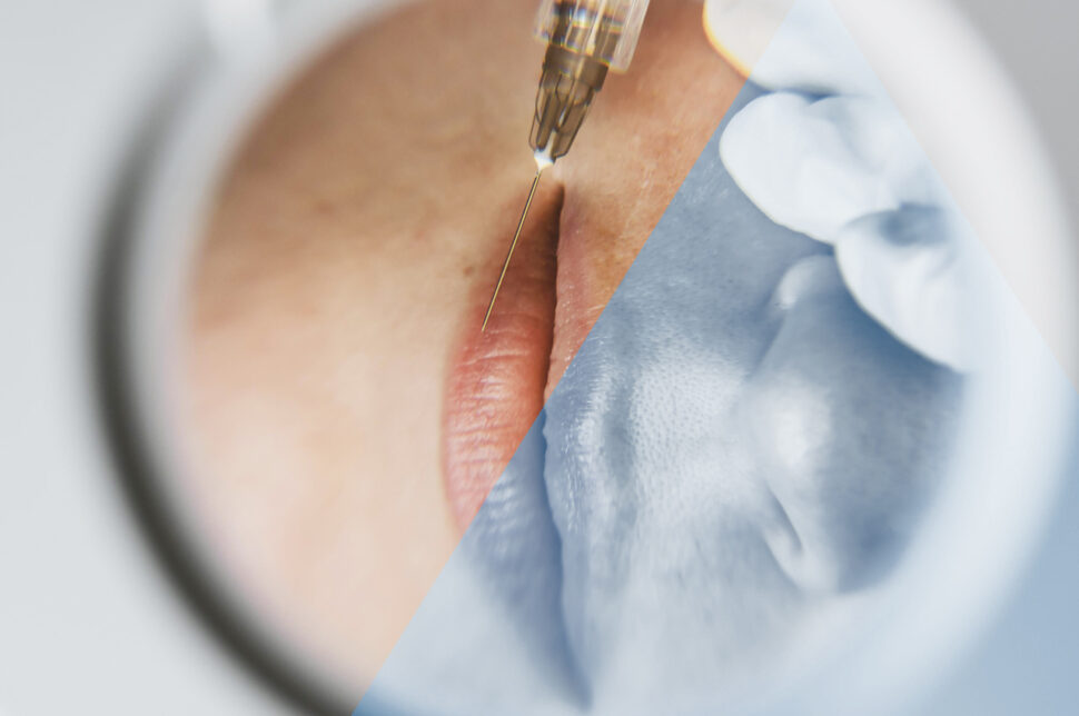 Trattamenti di Medicina estetica - HTC Centro Medico Stradella PV