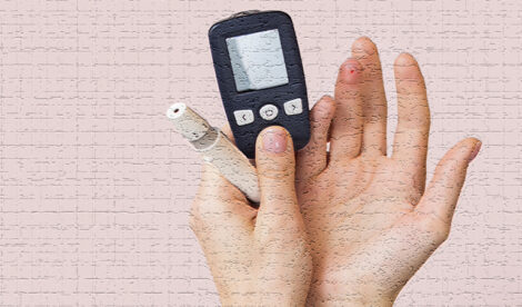 pre-diabete - endocrinologo - HTC Centro medico Stradella Pavia